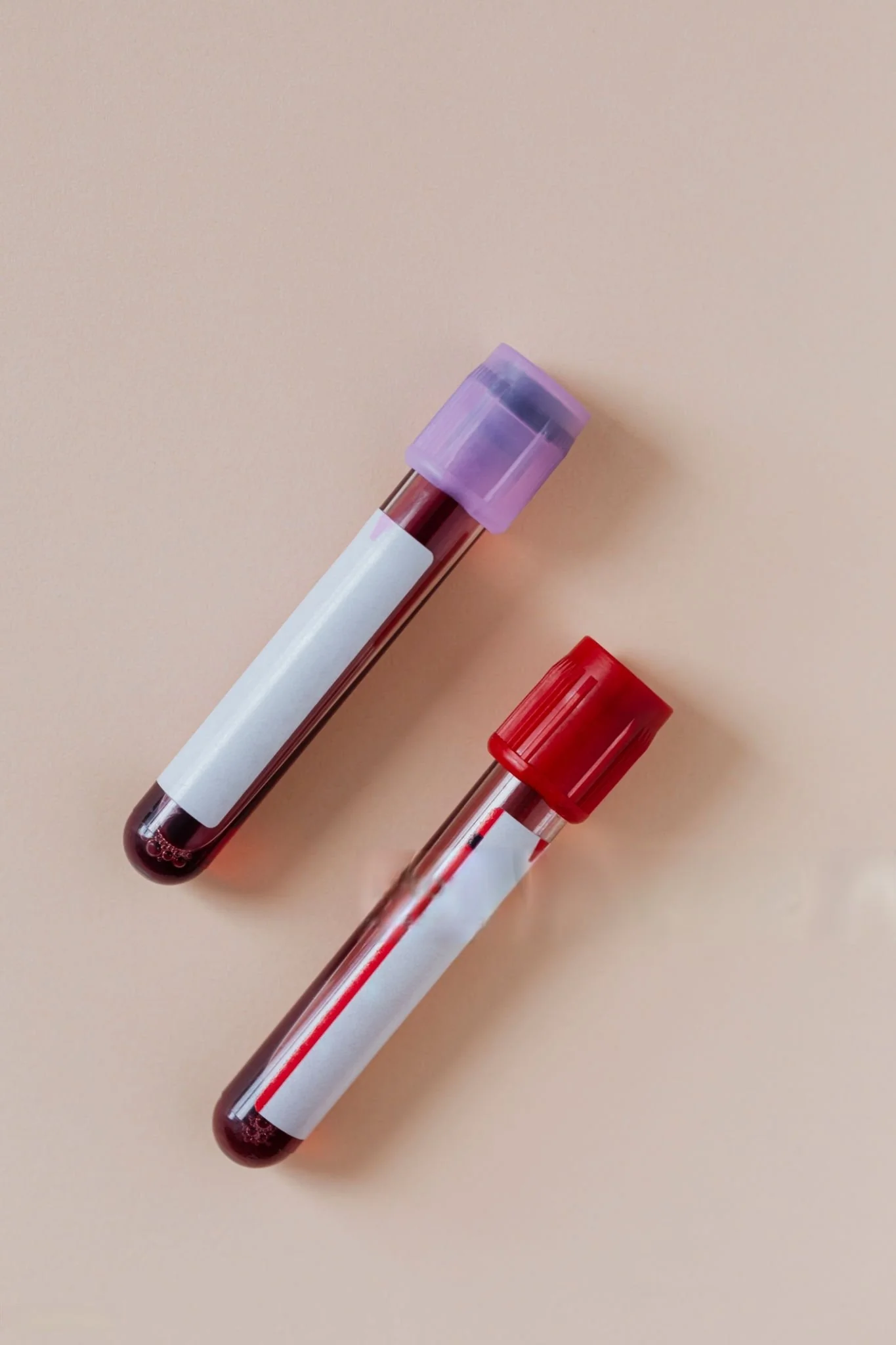 Vitamin D and B12 Panel